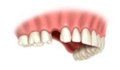 Cherry Hill Dental Excellence | Oral   Maxillofacial Surgery, Botox for TMJ and Headache Pain and Endodontics